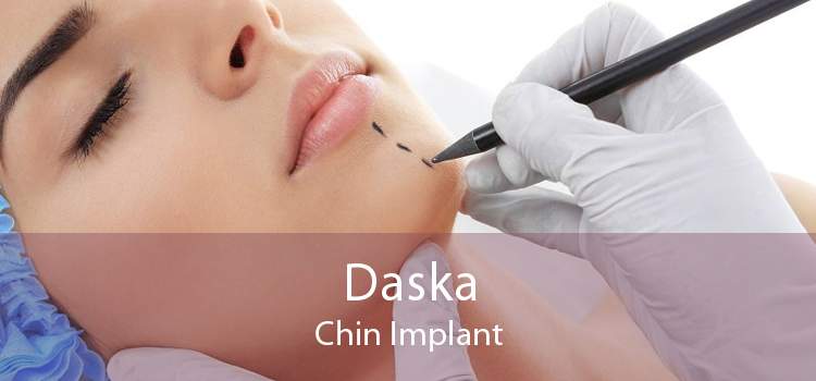 Daska Chin Implant