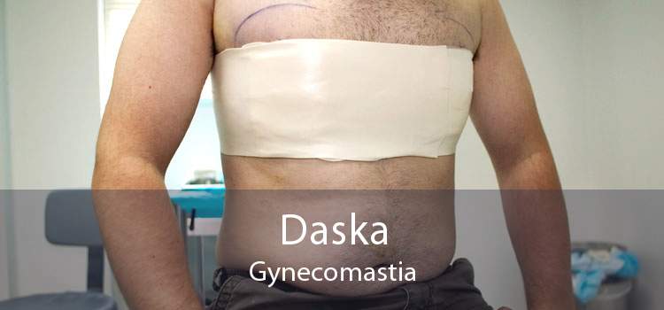 Daska Gynecomastia