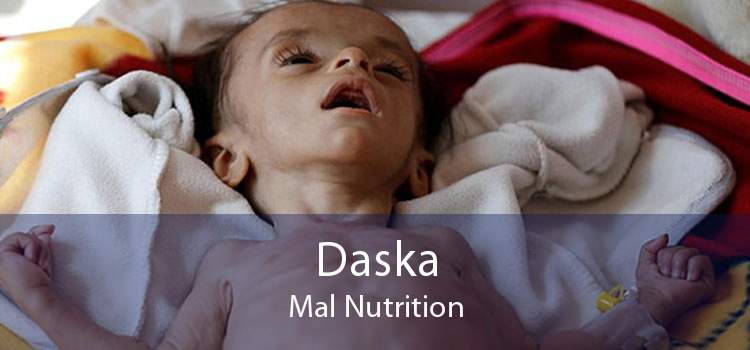 Daska Mal Nutrition