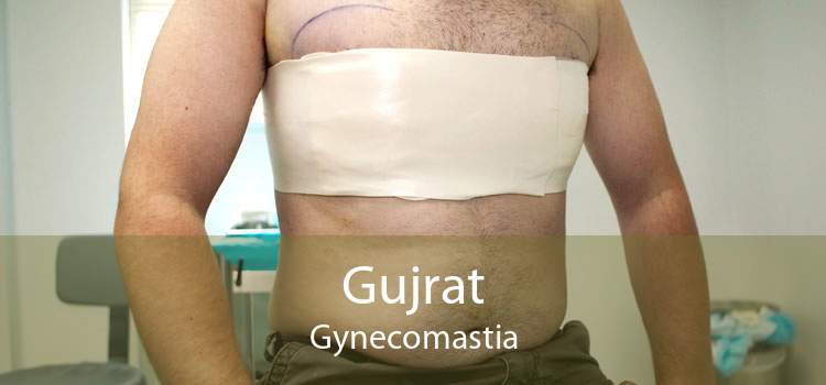 Gujrat Gynecomastia