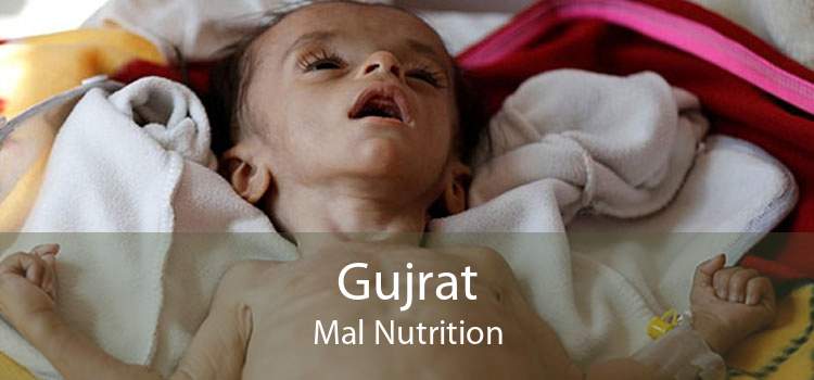 Gujrat Mal Nutrition