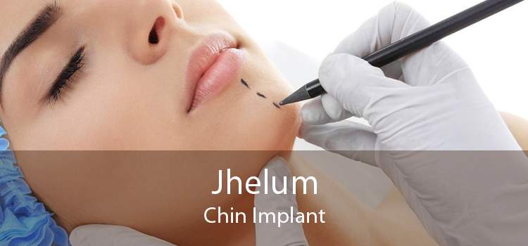 Jhelum Chin Implant