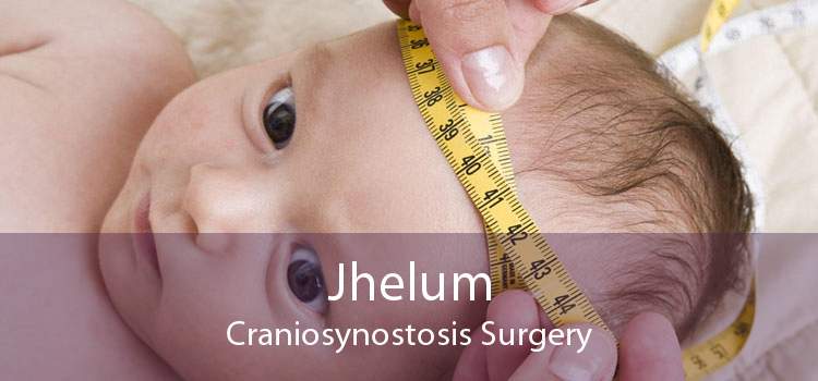 Jhelum Craniosynostosis Surgery