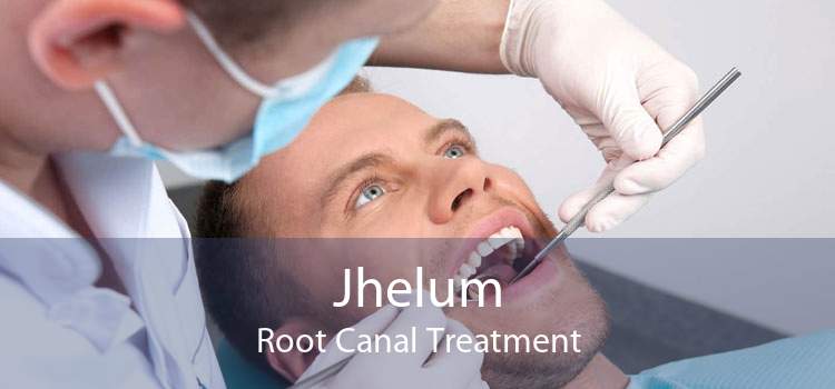 Jhelum Root Canal Treatment