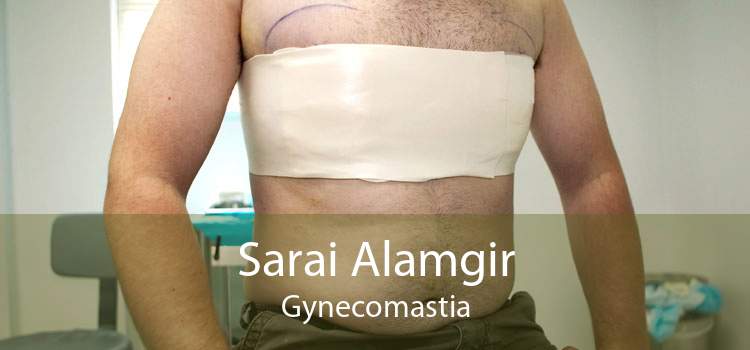Sarai Alamgir Gynecomastia