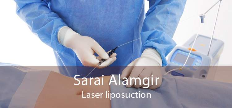 Sarai Alamgir Laser liposuction