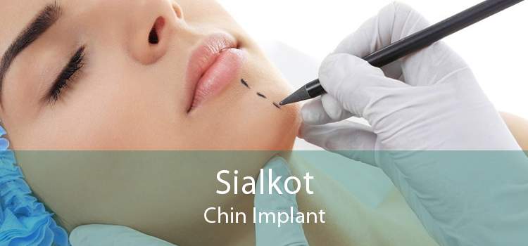 Sialkot Chin Implant